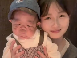 Viral Pria 25 Tahun Bertubuh Bayi, Ternyata Idap Kelainan Langka Sejak Kecil