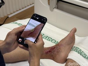 Cerita Dokter dan Perawat Pakai Gadget Apple untuk Rawat Pasien