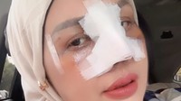 Potret Terbaru Elly Sugigi Setelah Oplas, Kini Berhidung Mancung