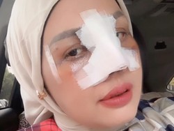 Tak Puas Oplas Hidung dan Mata, Elly Sugigi Incar Permak Gigi dan Facelift