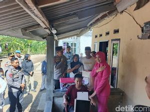 Kapolda NTB Ajak Santri Korban Dibakar Berobat ke RS Bhayangkara