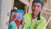 PMI Ai Juariah Belum Bisa Dipulangkan, Ini Penyebabnya
