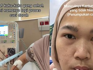 Viral Wanita Bekasi Cuci Darah karena Gagal Ginjal Stadium 5, Ini Gejala yang Dialami