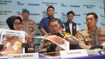 Bocah di Bekasi Dianiaya Ibu Tiri saat Ditinggal Ayah Kerja di Luar Negeri