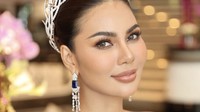Ratu Kecantikan Ini Gelarnya Dicopot, Batal Ikut ke Final Miss Supranational
