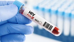 Video: dr Boyke Beberkan Rumus ABCDE untuk Cegah HIV