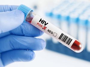 Fakta-fakta Kasus HIV di Sidoarjo, Kemenkes-Dinkes Buka Data Sebenarnya