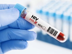Fakta-fakta Kasus HIV di Sidoarjo, Kemenkes-Dinkes Buka Data Sebenarnya