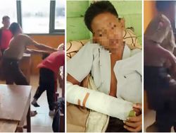 Polisi Dalami Kasus Bullying Siswa SMP di Lampung hingga Tangan Korban Patah