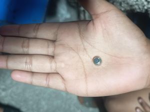 Ngilu! Baterai Jam Masuk Telinga Bocah Tasik, Damkar Turun Tangan