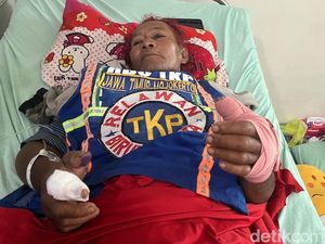 Petaka Relawan Mojokerto Ingin Jadi Pawang Ular Malah Digigit Kobra