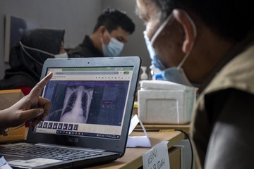 Punya Inovator Teknologi Kesehatan di Daerah? Daftarkan ke DPD RI Awards