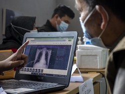 Punya Inovator Teknologi Kesehatan di Daerah? Daftarkan ke DPD RI Awards
