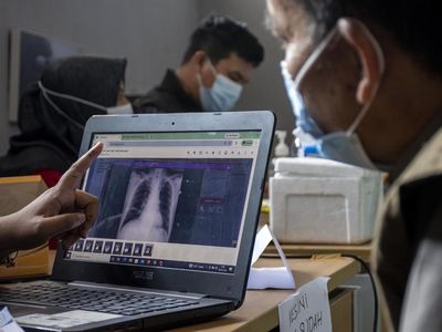 Skrining TB dan Cek Kesehatan Gratis Digelar bagi Warga Kawasan Karst