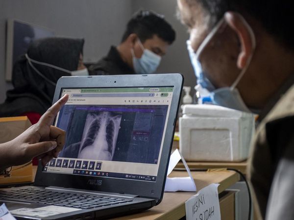 Skrining TB dan Cek Kesehatan Gratis Digelar bagi Warga Kawasan Karst