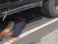 Nekat Salip Truk dari Kiri, Pemotor Perempuan di Gempol Patah Kaki