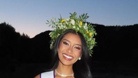Rahasia Senyum Agnes Rahajang di Miss Supranational, Ternyata Pakai Veneer