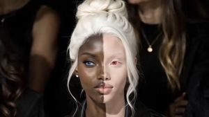 Model dengan Kulit 2 Warna Viral, Ternyata Bukan Manusia Asli