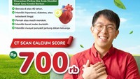 Ada Promo Menarik untuk Cek Kesehatan Jantung di RS St. Carolus