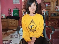 Sahabat Baik, Mari Bantu Osi Punya Kaki Palsu agar Bisa Lanjut Sekolah