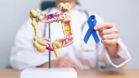 Waspada! Ini Sederet Jenis Kanker yang Mulai Banyak Ditemukan di Usia Muda