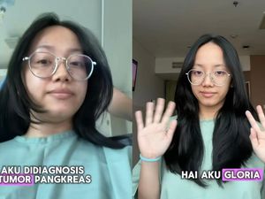 Viral Wanita 26 Tahun Kena Tumor Pankreas, Sempat Dikira Gejala Maag
