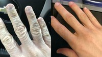 Bikin Melongo! Foto Before-After Ini Tunjukkan Perubahan Ekstrem