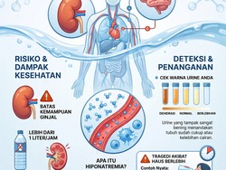 Infografis: Bahaya Minum Air Putih Terlalu Banyak