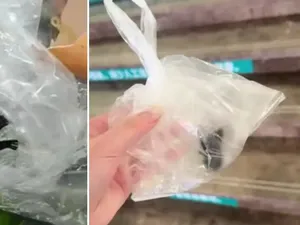 Diduga Gegara Kelelawar di Makanan Restoran, Bocah Ini Masuk RS!