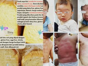Kasus Bakery Gluten Free Palsu Berlanjut, Pelapor Malah Jadi Terlapor
