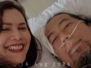 Sandy PAS Band Perlihatkan Kondisi Terkini Yukie Usai Kecelakaan