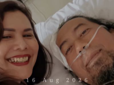 Sandy PAS Band Perlihatkan Kondisi Terkini Yukie Usai Kecelakaan