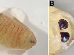 Merinding! Ada 10 Larva Bersarang di Hidung Wanita Ini