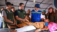 Menkes Kirim Dokter Ortopedi ke NTT, Tangani Pasien Patah Tulang Termasuk Usia Anak