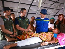 Menkes Kirim Dokter Ortopedi ke NTT, Tangani Pasien Patah Tulang Termasuk Usia Anak