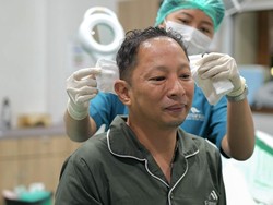Ringgo Agus Rahman Lanjut Transplantasi Rambut Tahap Kedua, Pilih Produk Lokal