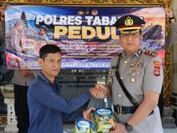 Polres Tabanan Bantu Ringankan Beban Keluarga Anak dengan Kelainan Jantung