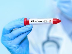 AS Terbitkan Travel Warning ke Bali gegara Virus Zika, Dinkes: Belum Ada Kasus