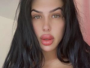 Aksi Nekat Wanita yang Dijuluki Bibir Terbesar, Suntik Filler Sendiri di Rumah