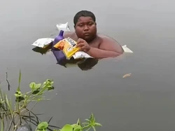 Remaja Ini Berendam di Kolam Selama 5 Tahun karena Kulit Terasa Terbakar