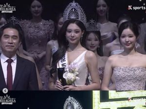 10 Potret Dulu vs Sekarang Woo Seo Yoon, Miss Korea 2026 Dituding Oplas