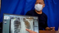 82 Juta Warga Sudah Ikuti Cek Kesehatan Gratis, Penyakit Ini Banyak Ditemukan