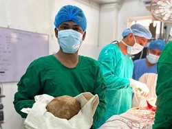 Batu Kandung Kemih Raksasa Seberat 3,1 Kg Diangkat dari Tubuh Pasien Umur 52