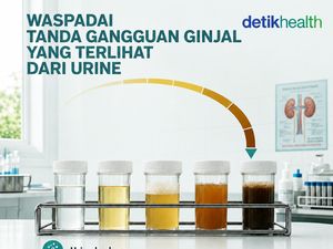 Infografis: Waspadai Tanda Ginjal Rusak, Bisa Terlihat dari Perubahan Urine