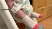 Sering Menahan BAB Bikin Anak Kena Usus Buntu? Pakar IDAI Ungkap Faktanya