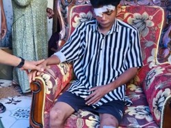 Kronologi 3 Penambang Emas Tewas Tertimbun Longsor di Sumbawa