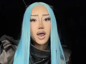 Wajah North West Berubah, Netizen Curiga Operasi Hidung di Usia 13