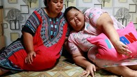 Kisah Pilu Remaja di Bogor Dibully dan Putus Sekolah karena Idap Obesitas