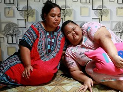 Kisah Pilu Remaja di Bogor Dibully dan Putus Sekolah karena Idap Obesitas