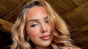 Foto Miss Austria yang Meninggal di Usia 22, Punya Riwayat Penyakit Jantung
